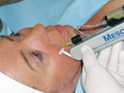 Cosmetische mesotherapie